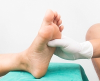 Diabetics May Be at Risk for Charcot Foot
