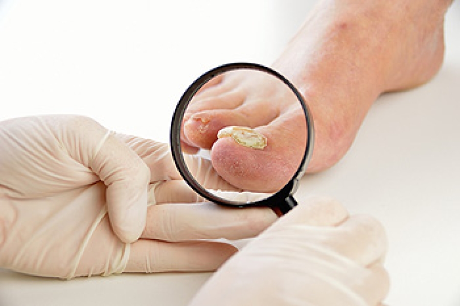 Scalp Dermatologist London | Hair Loss, Alopecia, Fungus | Eudelo  Dermatology