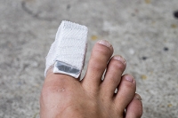 Buddy Taping or Surgery May Be Options for a Broken Toe